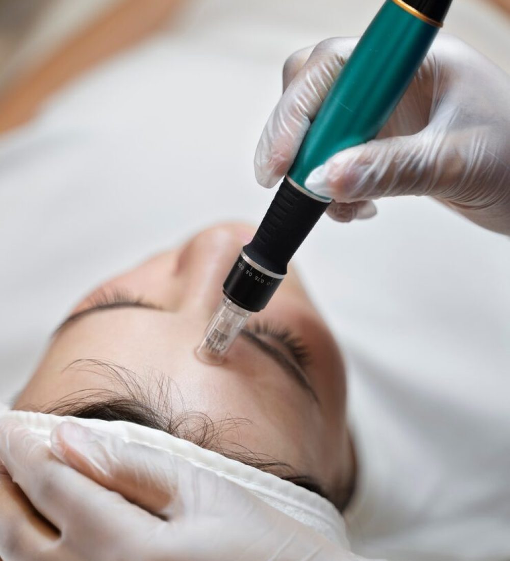 person-getting-micro-needling-beauty-treatment_23-2149334260